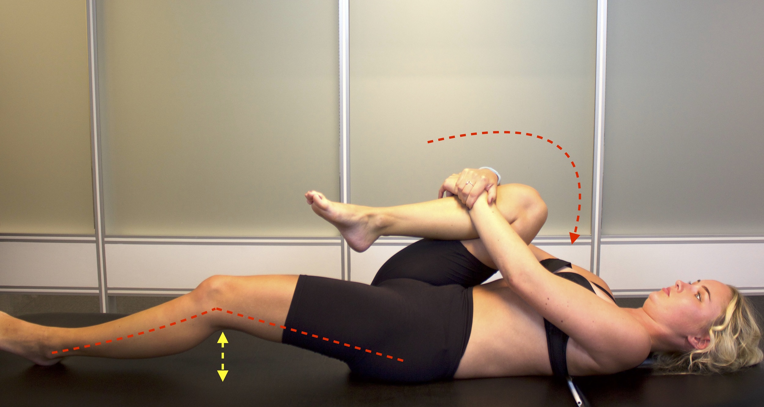 Iliopsoas test - positiv