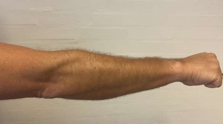 Tennisalbue-øvelse 1