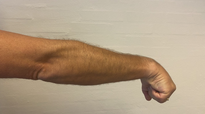 Tennisalbue-øvelse 2